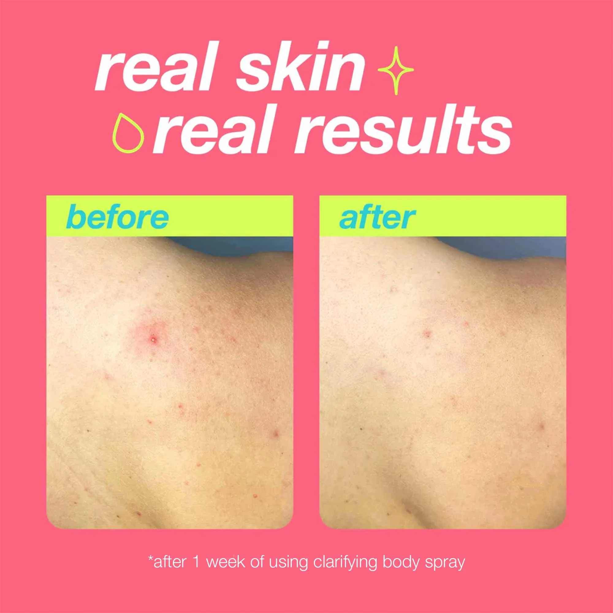 Body Breakout Duo - Image 3